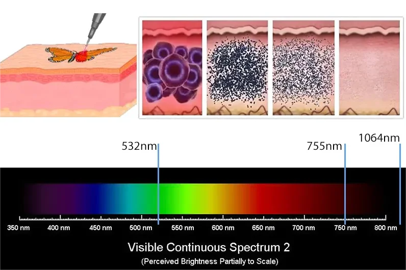 ADG TOP Quality Picosecond Tatto Removal Laser