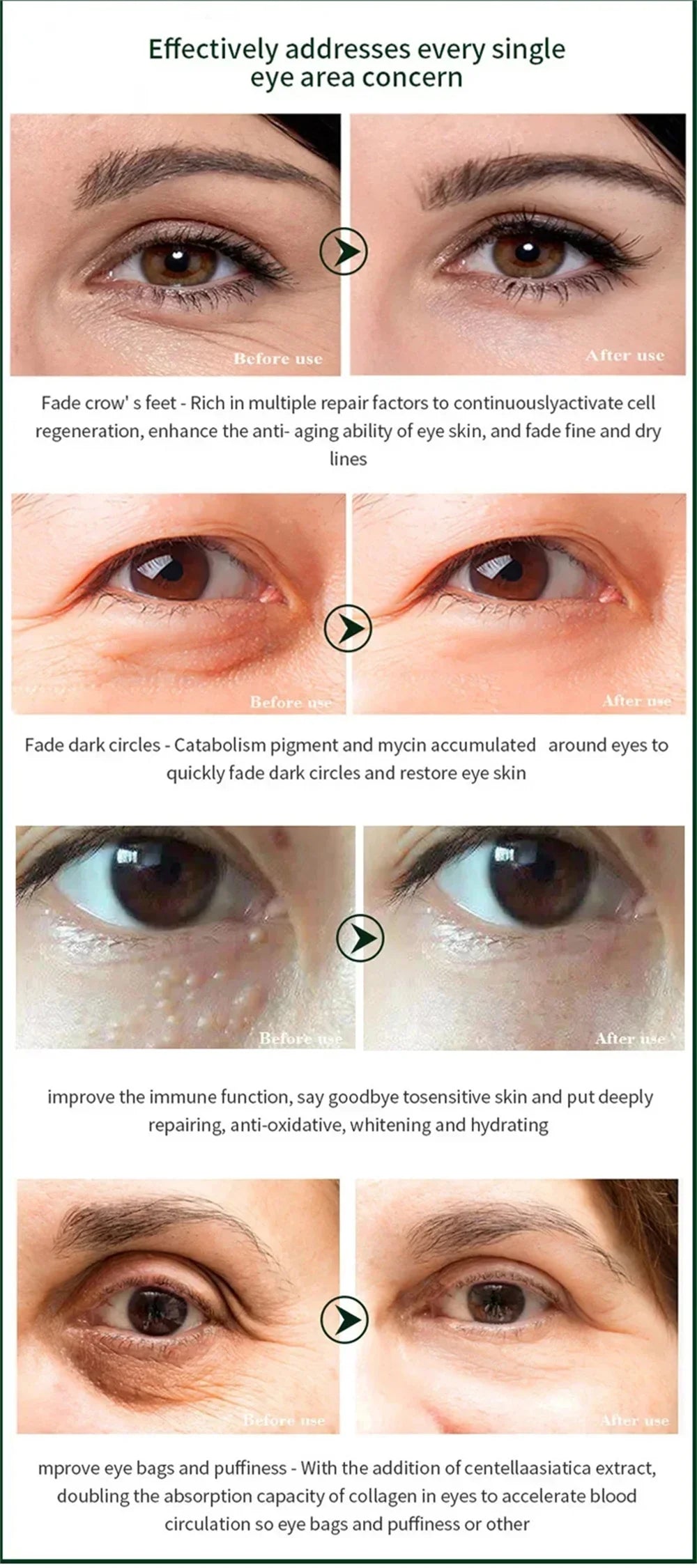 Fat Granules Removal Eye Serum Anti Dark Circle