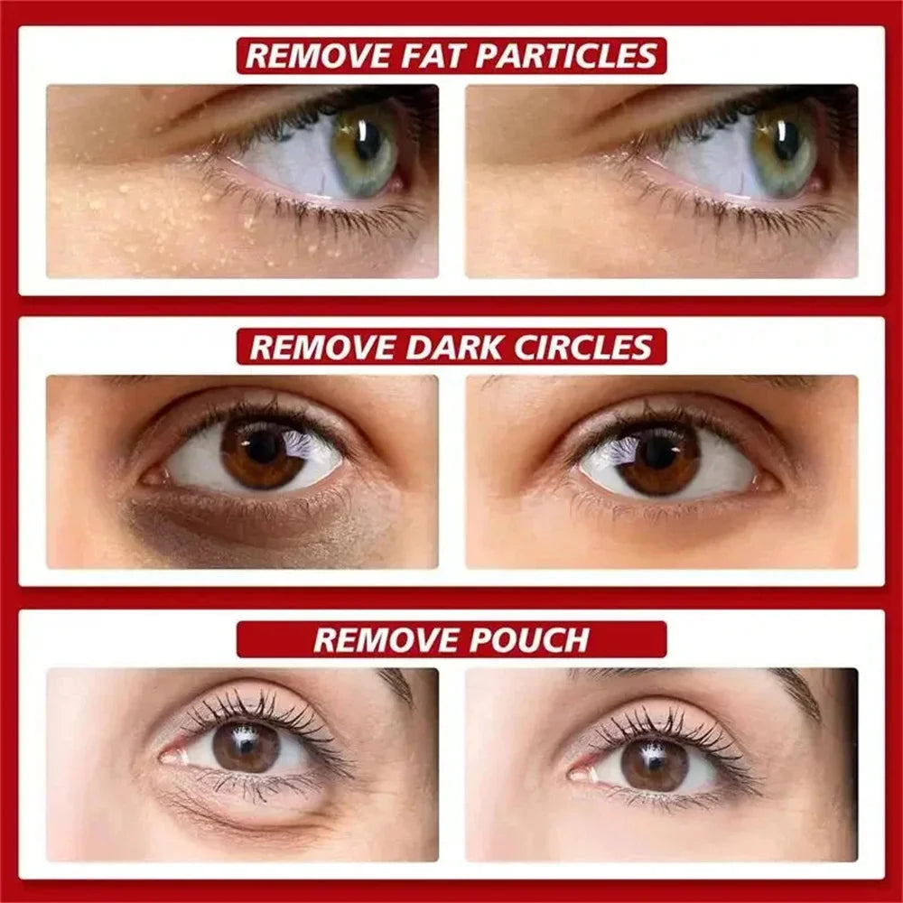 Fat Granules Removal Eye Serum Anti Dark Circle