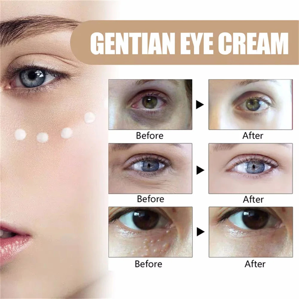 Fat Granules Removal Eye Serum Anti Dark Circle