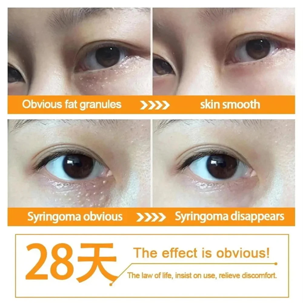 Fat Granules Removal Eye Serum Anti Dark Circle